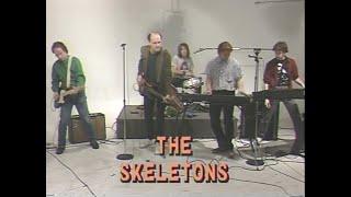 The Skeletons -- on Art Fein's Poker Party