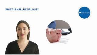 What is hallux valgus