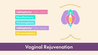 Labiaplasty, Hood Reduction and more... | Dr. Javier Saldaña