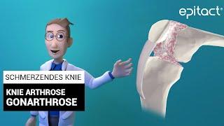 Knie Arthrose / Gonathrose | Erklärungen - EPITACT®