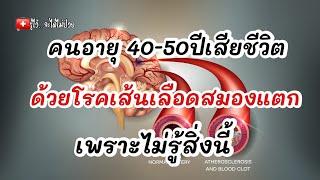 คนวัย 40-50ปี เสียชีวิตด้วยโรคหลอดเลือดสมองแตกเพราะไม่รู้สิ่งนี้|รู้ไว้จะได้ไม่ป่วย|เส้นเลือดสมองแตก