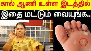 கால் ஆணியை குணப்படுத்த சில எளிய இயற்கை வைத்திய முறைகள்! Dr.Rajalakshmi | ASM INFO