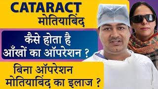 The most modern treatment for Cataract (White Cataract) - Artificial Intelligence Laser Cataract Surgery