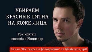 Убираем красные пятна на коже лица. Три крутых способа в Photoshop