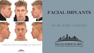 A Look Inside The OR: Facial Implants by Dr. Randy Sanovich at Dallas Surgical Arts