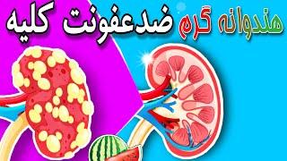 عفونت کلیه | فقط در  5 روز عفونت کلیه رو با هندوانه گرم درمان کنید | تشخیص بیماری کلیه