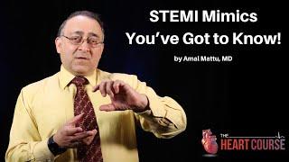 STEMI Mimics You’ve Got to Know! | The Heart Course