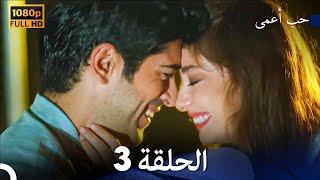 حب أعمى الحلقة 3 (Arabic Dubbed)