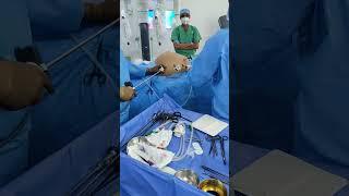 Inserting a 15 cm mesh in Robotic TARUP Surgery for Umbilical Hernia #drvishalsoni