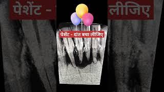 पेशेंट - दांत बचा लीजिए..#youtube #trending #shorts #dental