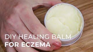 Tutorial for making a Natural Healing Cream for Eczema and Psoriasis