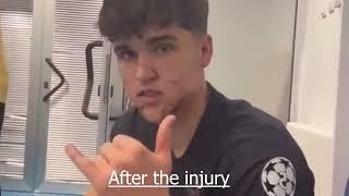 cubarsi injury