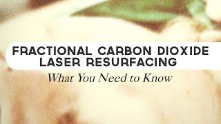 Fractional Carbon Dioxide Laser Resurfacing