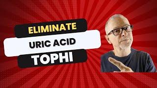 Gout: Eliminate Uric Acid Tophi