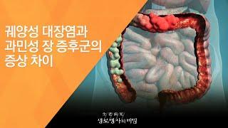 궤양성 대장염과 과민성 장 증후군의 증상 차이 - (2017.2.8_609회 방송)_화장실의 고통, 과민성 장 증후군