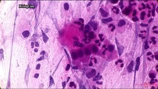 Microscope Camera? Comparison of Omax 18mp vs RisingCam (Sony IMX572), Sputum Smear H&E stained (4K)