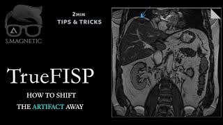 TrueFISP – HOW TO SHIFT THE ARTIFACT AWAY