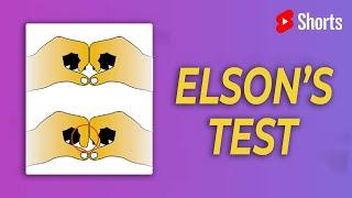 The Modified Elson's Test