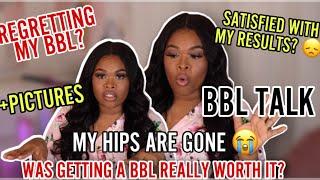 Is  BBL Worth it? | BBL Talk | Amber Sharniece