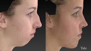 A New Frontier For Facial Plastic Surgery Using 3D Technology