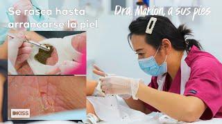 Sufre psoriasis desde los 16 años y no encuentra solución | Dra  Marion, a sus pies