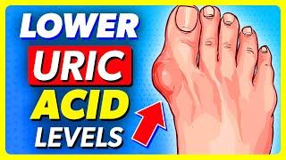 20 SUPER Foods That Help LOWER Your Uric Acid Levels!