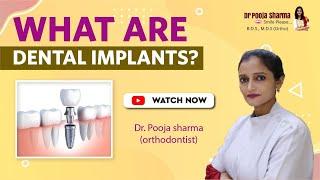 What Is Dental Implant -Treatment in Agra, India | Dr Pooja Sharma | Orthodontic