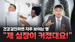 건강검진에서 심비대를 진단 받는다면? | 영남대학교병원 손장원 교수