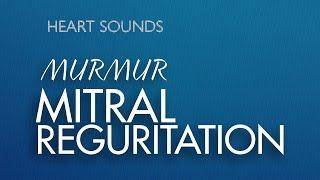 Mitral Regurgitation Murmur - Well Summarized alongwith MR Audio | Heart Sounds Made Easy