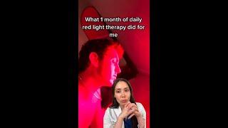 Red light therapy