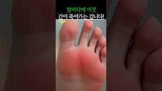 발바닥에 생긴 이것! 간이 죽어가는 겁니다! #건강 #건강정보