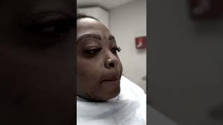 Eyebrows transplant #hairtransplant  | Care4Hair