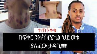 Ethiopia: በፍቅር ንክሻ (ሂኪ) ህይወቱ ያለፈው ታዳጊ!  |WezWez Addis