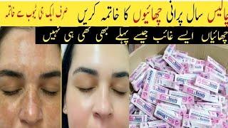 Remove pigmentation, freckles melasma & darkspots | Nims and beauty skin whitening freckle cream