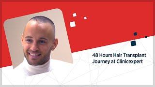 48 Hours Journey For Hair Transplant at ClinicExpert