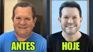 7 FAMOSOS QUE FIZERAM HARMONIZAÇÃO FACIAL e ESTÃO IRRECONHECIVEIS #13