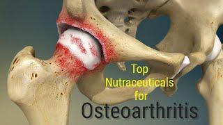 Top Nutraceuticals for Osteoarthritis