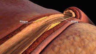 LDL and HDL Cholesterol | Good and Bad Cholesterol | Nucleus Health