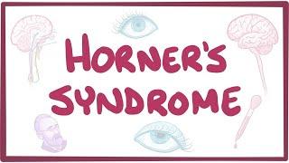 Horner's syndrome - causes, symptoms, diagnosis, treatment, pathology