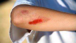 How to Treat Cuts & Scrapes | First Aid Training