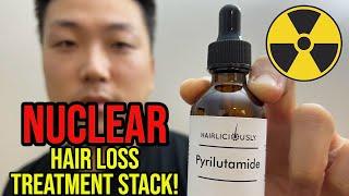 MY NUCLEAR HAIR LOSS TREATMENT STACK (I STARTED PYRILUTAMIDE!)