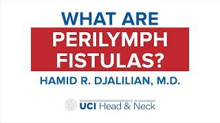 What are Perilymph Fistulas? by Dr. Hamid Djalilian - UCI Head & Neck