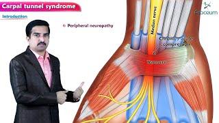 Carpal tunnel syndrome Anatomy Animation