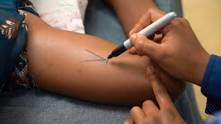 Inserting a Two Rod Implant, Teaching Short (Health Workers), French - Family Planning Series