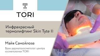 Инфракрасный термолифтинг Skin Tyte II