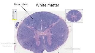 Histology with Chimmalgi: Spinal cord