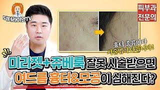 미라젯+쥬베룩을 잘못 시술받으면 여드름 흉터&모공이 더 심해진다고요? 미라젯+쥬베룩 치료법 2가지 비교 분석!