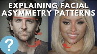 Why You Have An Asymmetrical Face - The Right TMCC Pattern