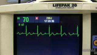 EKG Training: Watching and Interpreting the Defibrillator Monitor