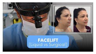 Liquid vs Surgical Facelift | Zuri Plastic Surgery